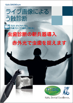 ライブ画像によるう蝕診断・虫歯診断の新兵器 DiagnoCam(KaVo社)