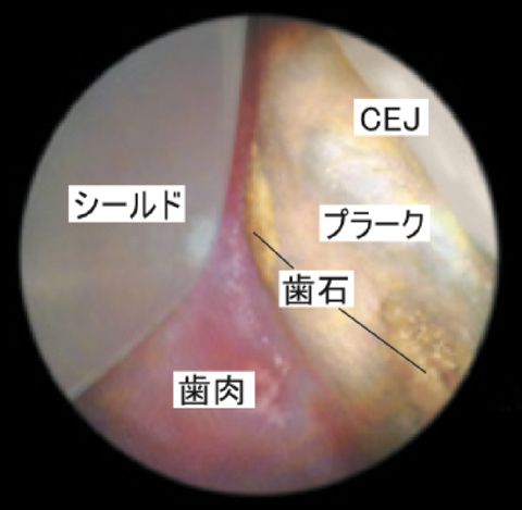 モニターで見られる実際の画像