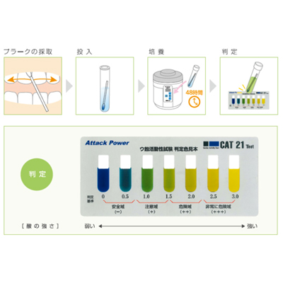 リスク把握のための唾液検査の実施（虫歯のリスク検査）