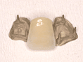 ピンレッジ・左右の灰色の部分が隣の歯の裏に付きます