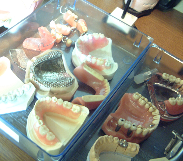 つくばヘルスケア歯科クリニックのオプション治療