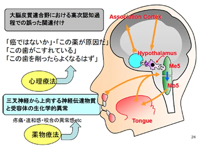 歯科心身症／口腔心身症：検査で目立った異常がないのに痛みや違和感が続く状態で